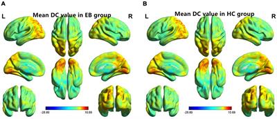 Alteration of Degree Centrality in Adolescents With Early Blindness